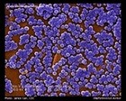 Staphylococcus aureus SEM micrograph